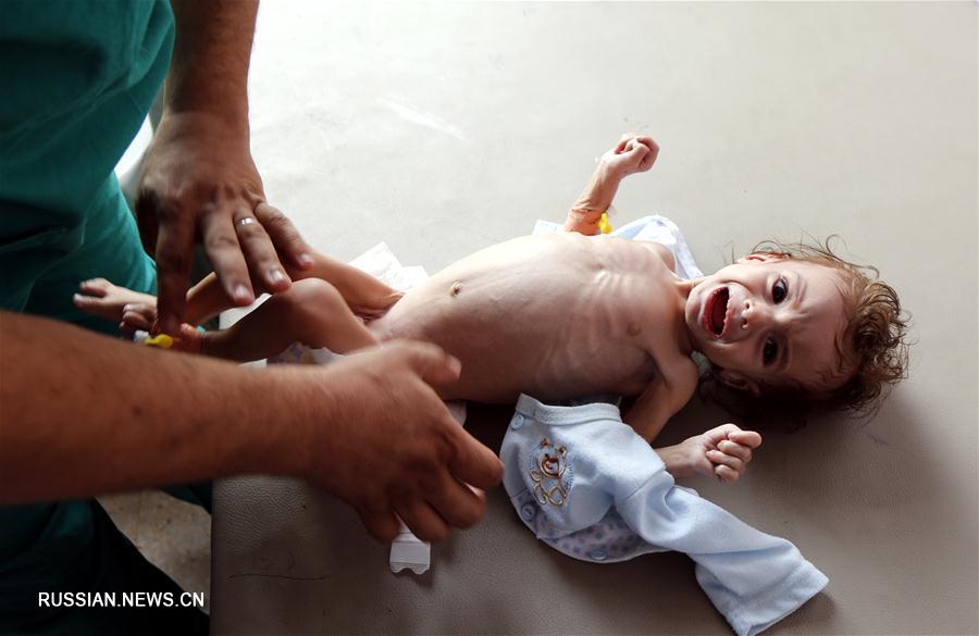 ООН предупреждает об угрозе массового голода в Йемене